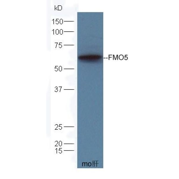 Anti-FMO5 antibody