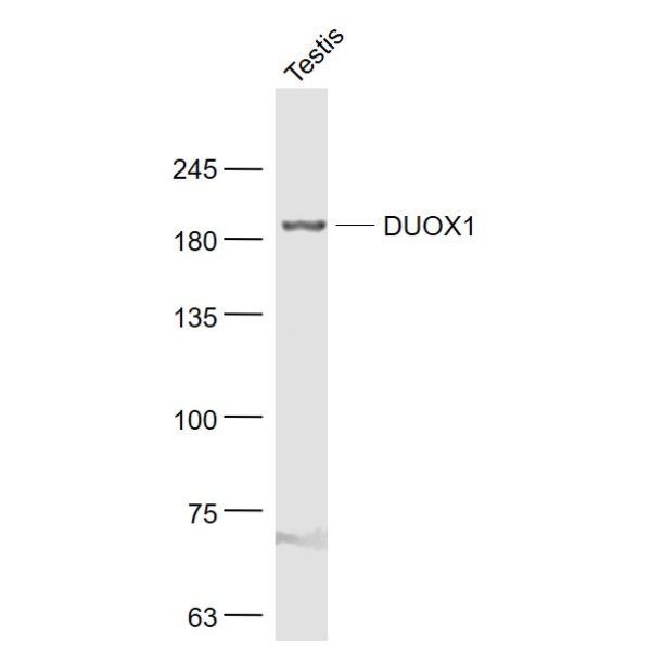 Anti-DUOX1 antibody