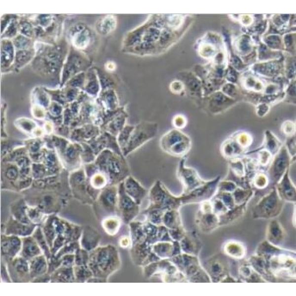 MHCC-97H 人高转移性肝癌细胞(通过STR鉴定)