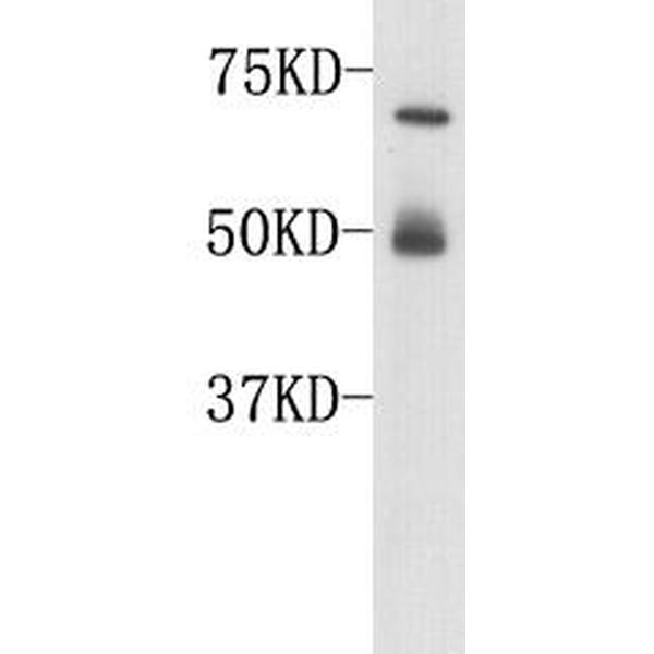 Anti-Complement C3(β chain) antibody