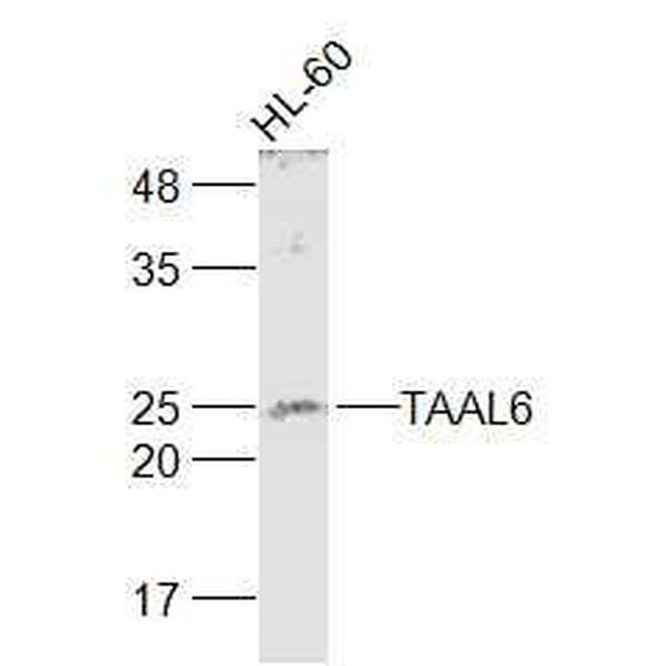 Anti-Synaptotagmin XII antibody