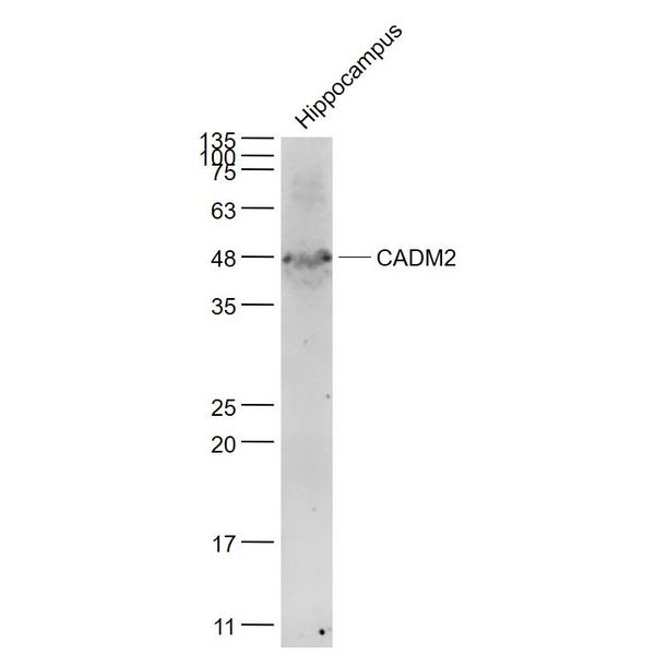 Anti-CADM2 antibody