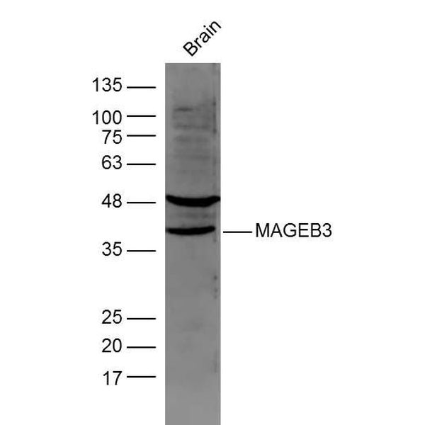 Anti-MAGEB3 antibody