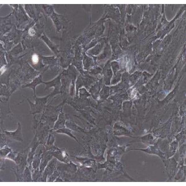 人胰岛细胞