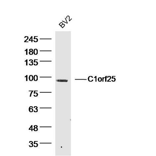 Anti-C1orf25 antibody