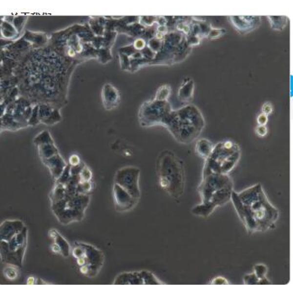 NCI-H520细胞（提供STR鉴定报告）