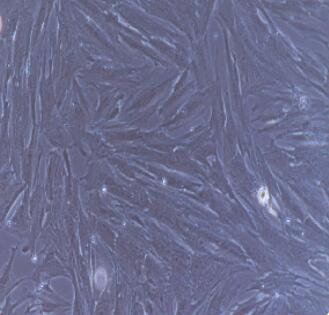 系膜细胞详述肾系膜细胞是肾小球内非常活跃的细胞,具有分泌细胞基质