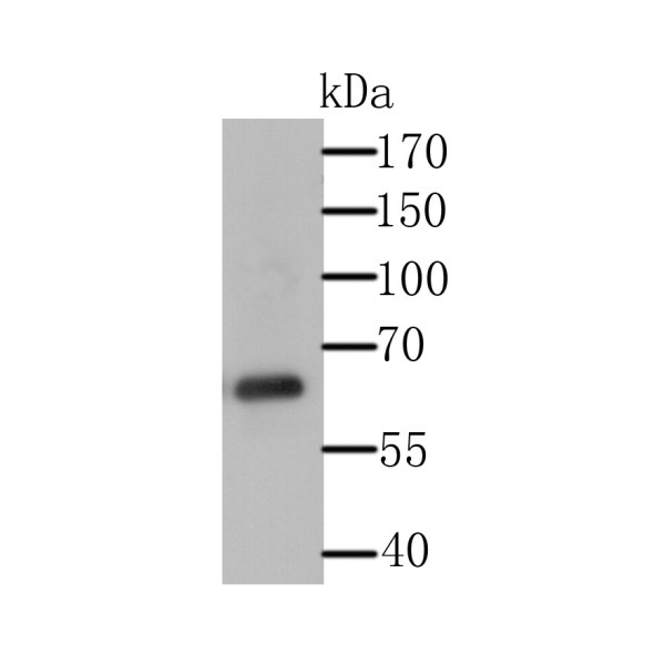 Anti-USP14 antibody