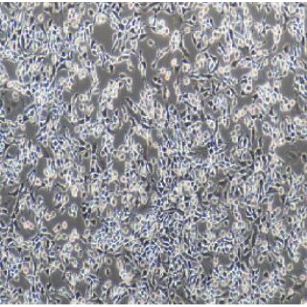 CHO-GS 中国仓鼠卵巢细胞（谷氨酰胺系统）