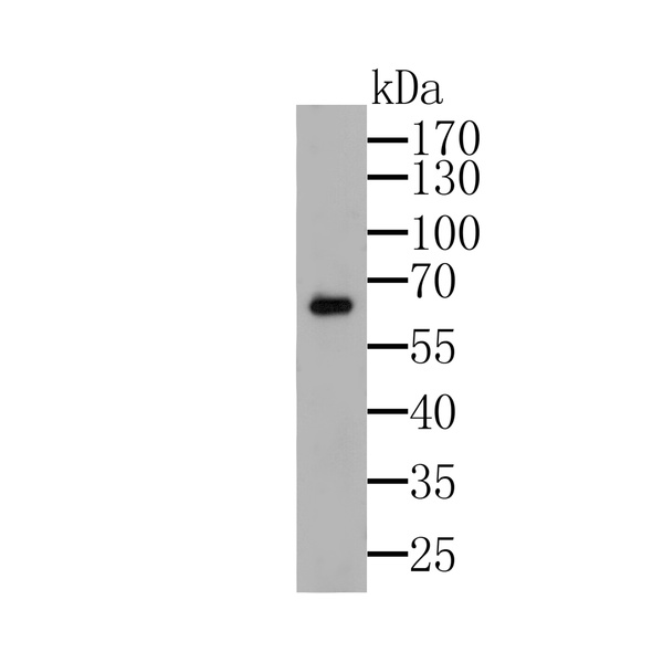 Anti-G-protein coupled receptor 30 antibody