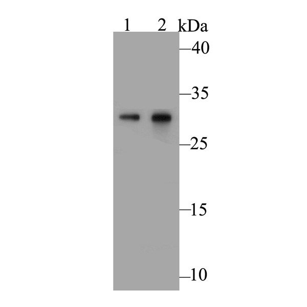 Anti-Galectin 3 antibody