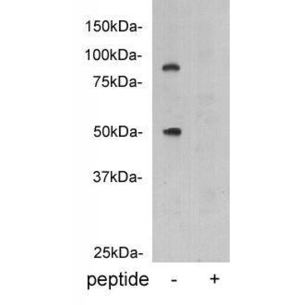 Anti-Vitamin K-dependent protein C antibody