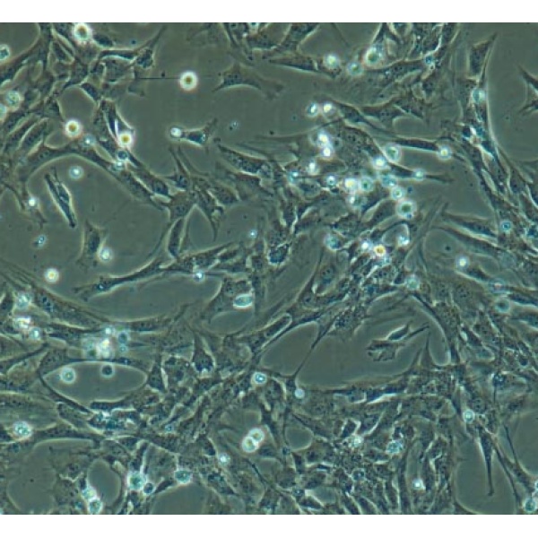 血管内皮内皮细胞图片
