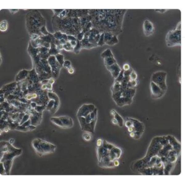 NCI-H520人肺鳞癌细胞(通过STR鉴定)