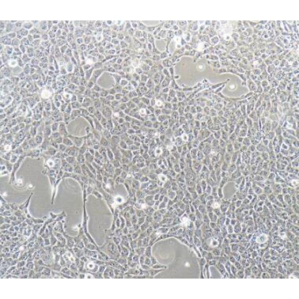 HBL-100 人整合SV40基因的乳腺上皮细胞(通过STR鉴定)