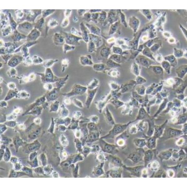 MUM2B 人侵袭性脉络膜黑色素瘤细胞(通过STR鉴定)
