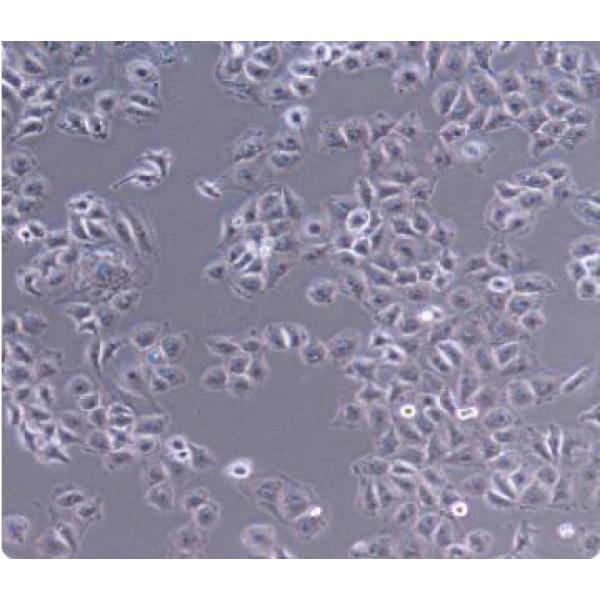 SGC-7901 人胃腺癌细胞