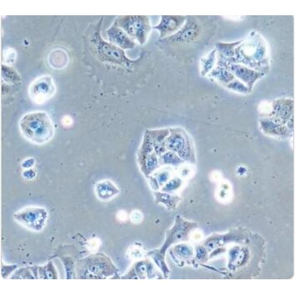 NCI-H358 人非小细胞肺癌细胞(通过STR鉴定)