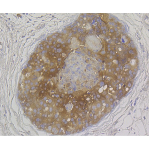 Anti-MICA + MICB antibody [3198]