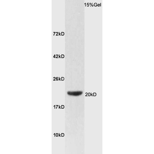 Anti-FAM210B antibody