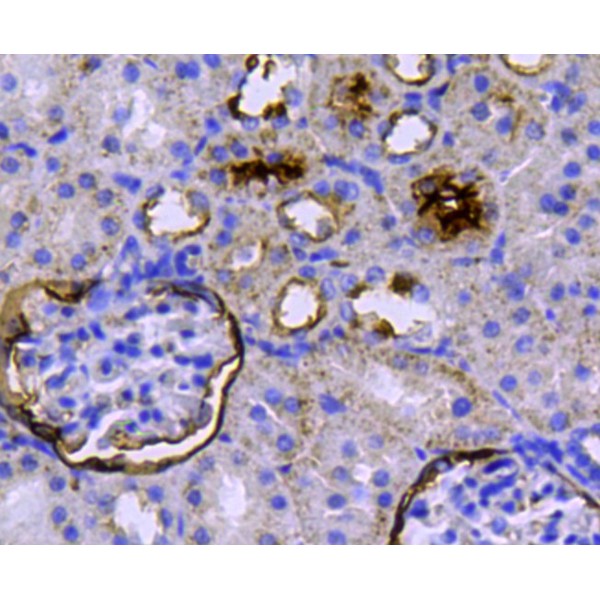 Anti-CD10 antibody