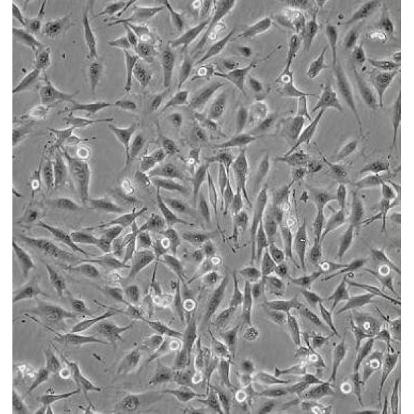 NCI-BL2009细胞（提供STR鉴定报告）
