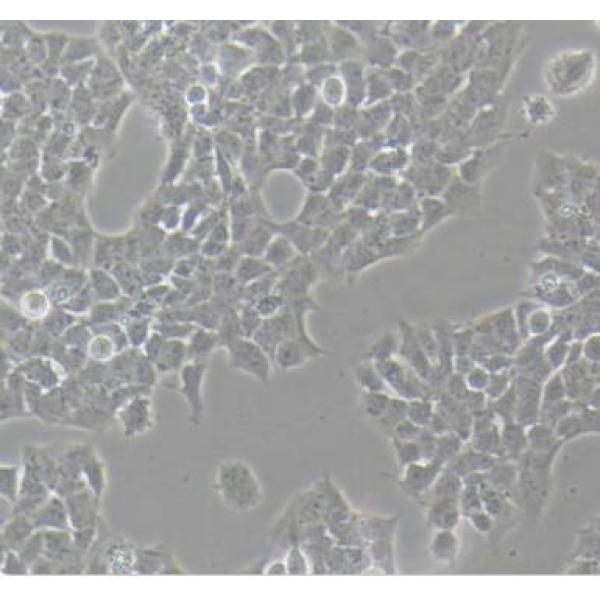 A673人横纹肌瘤细胞(通过STR鉴定)
