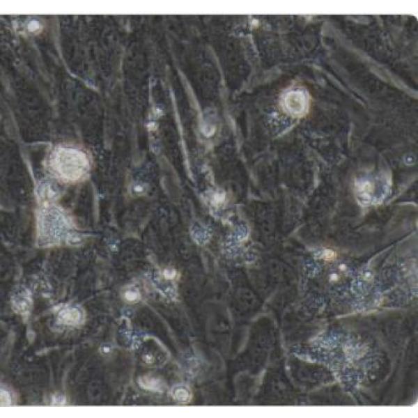 小鼠卵巢间质细胞