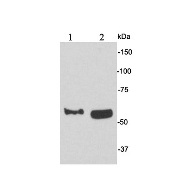 Anti-CD62E antibody