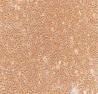 肾小球脏层上皮细胞图片