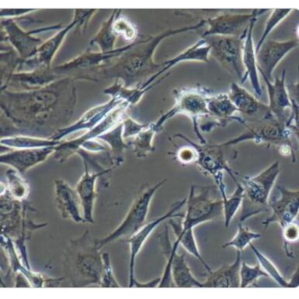 TC-32 人尤文氏肉瘤细胞