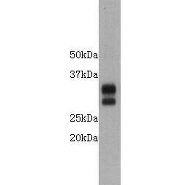 Anti-CD8 antibody