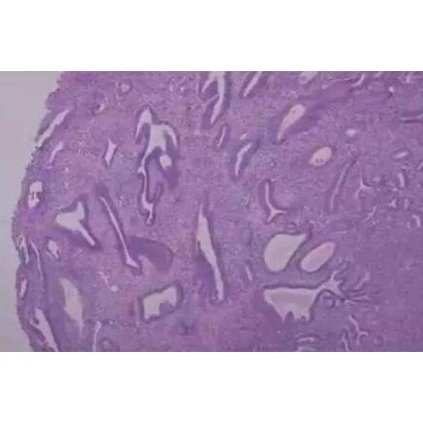 猪子宫内膜基质细胞