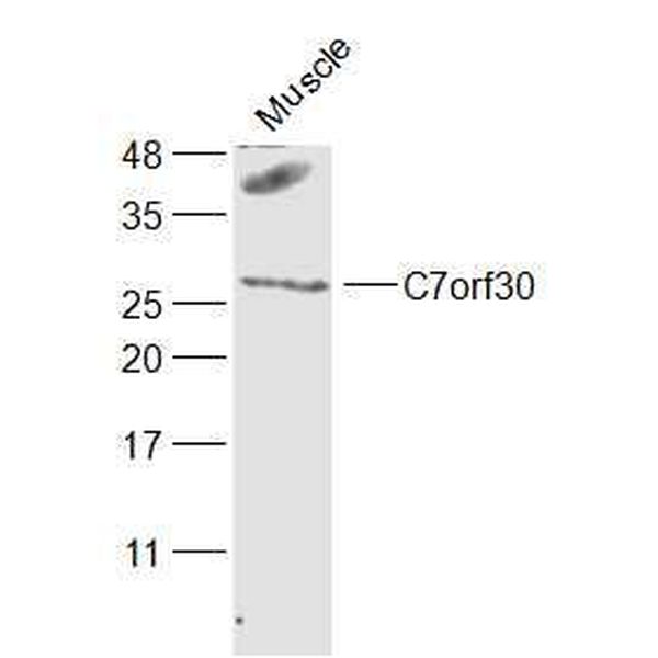 Anti-C7orf30 antibody