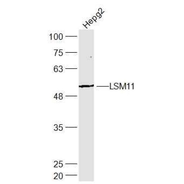 Anti-LSM11 antibody
