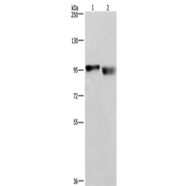 兔抗CIP2A多克隆抗体