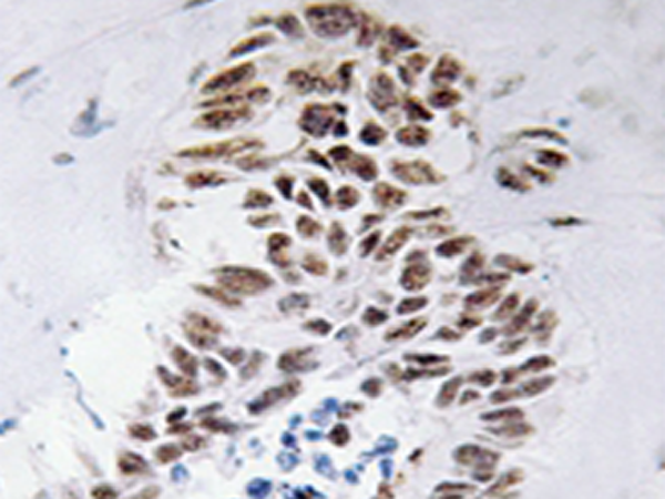 兔抗DAPK3(Ab-265) 多克隆抗体