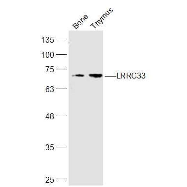 Anti-LRRC33 antibody