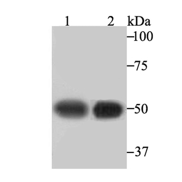 Anti-beta III Tubulin antibody