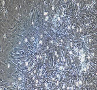 小肠隐窝细胞图片
