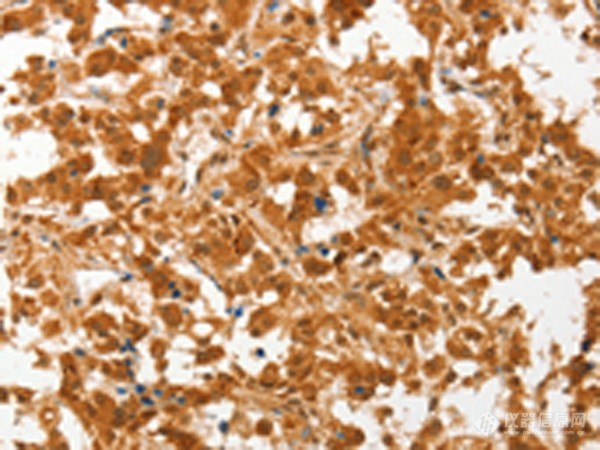 兔抗CERT1多克隆抗体.jpg