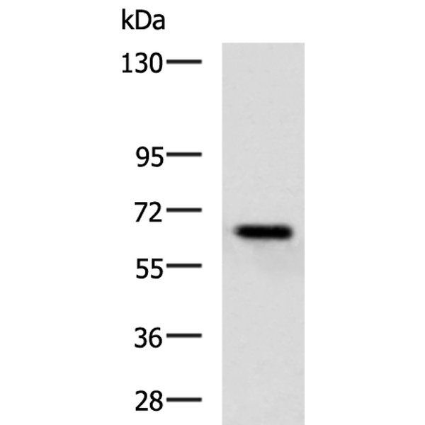 兔抗KBTBD8多克隆抗体