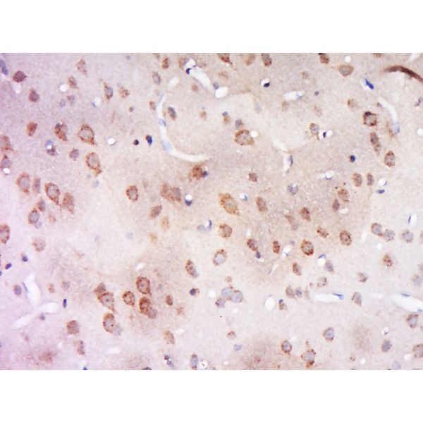 Anti-CCDC94 antibody