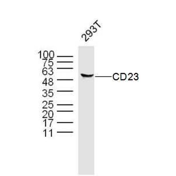 Anti-CD23 antibody