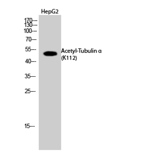 Anti-Tubulin α (Acetyl Lys112) antibody