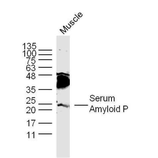 Anti-Serum Amyloid P antibody