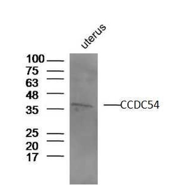 Anti-CCDC54 antibody