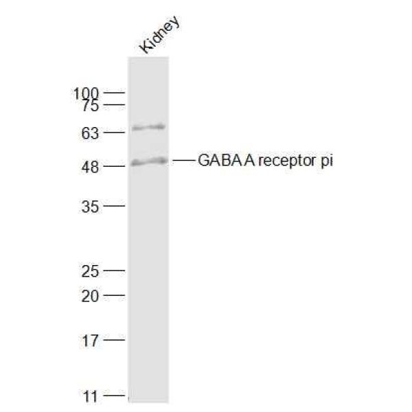 Anti-GABA A receptor pi antibody