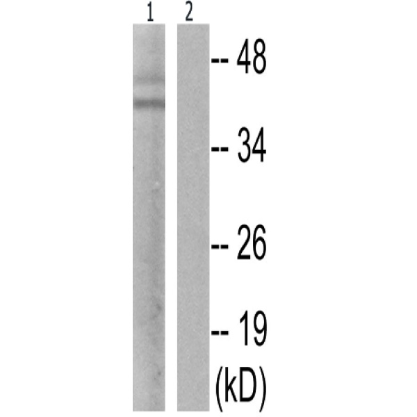 兔抗JUN(Phospho-Ser63) 多克隆抗体