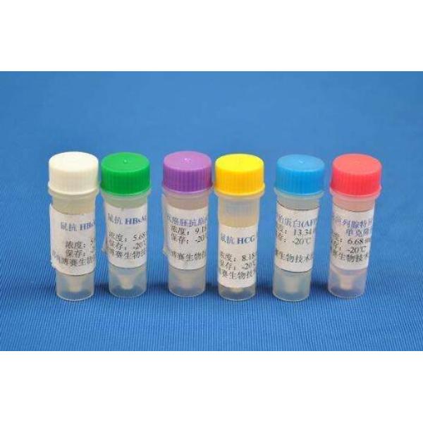 Anti-CHERP antibody